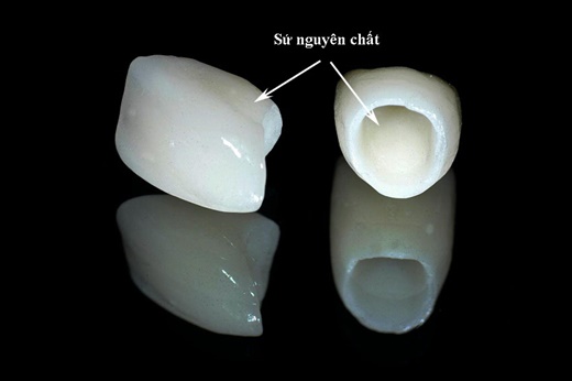 răng sứ nguyên chất